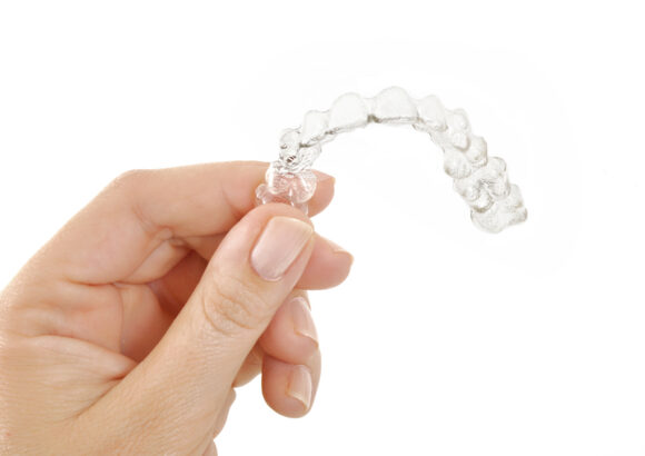 Invisalign